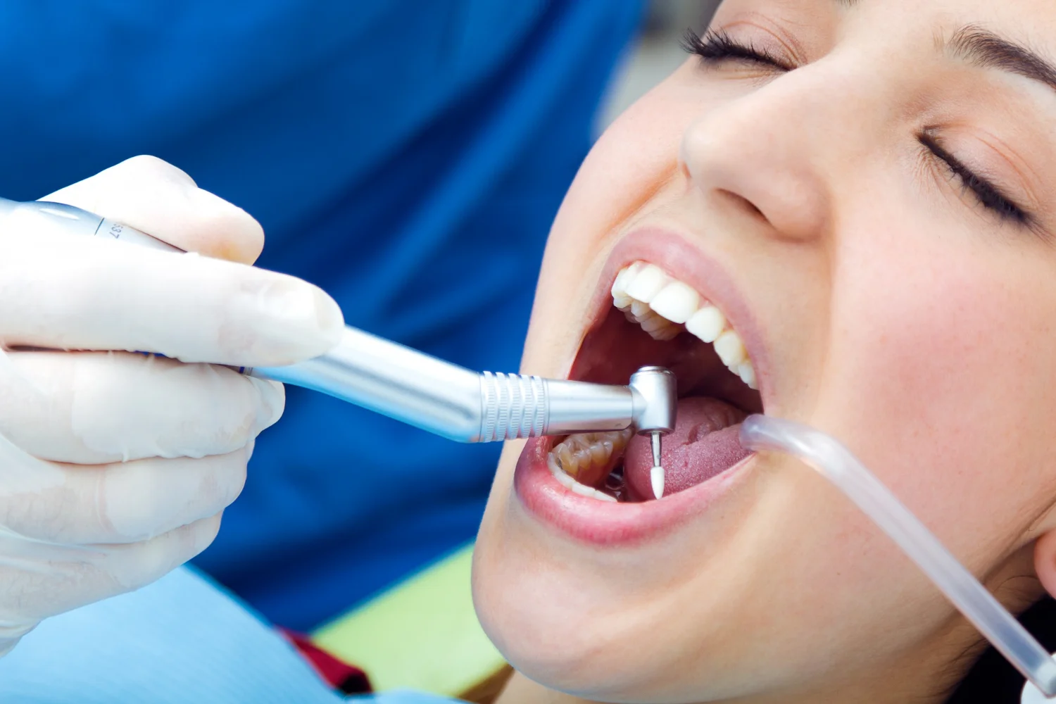 Diş Hekimi Mehmet Aykut Yaşar | Ankara Polatlı Diş Kliniği | Ankara Polatlı Diş Polikliniği | Ankara Polatlı Diş Hekimi | Ankara Polatlı Dolgu | Ankara Polatlı İmplant | Ankara Polatlı Çocuk Diş Hekimi | Ankara Polatlı Diş Çekimi | Ankara Polatlı Ortodonti | Ankara Polatlı Ağız Ve Diş Çene Cerrahisi | Ankara Polatlı 20’lik Diş Çekimi | Ankara Polatlı Gülüş Tasarımı