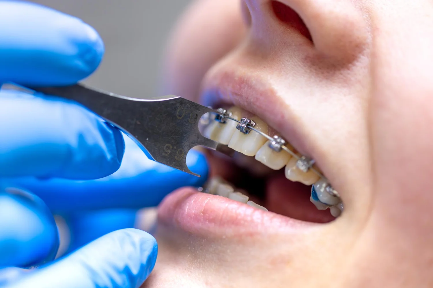 Diş Hekimi Mehmet Aykut Yaşar | Ankara Polatlı Diş Kliniği | Ankara Polatlı Diş Polikliniği | Ankara Polatlı Diş Hekimi | Ankara Polatlı Dolgu | Ankara Polatlı İmplant | Ankara Polatlı Çocuk Diş Hekimi | Ankara Polatlı Diş Çekimi | Ankara Polatlı Ortodonti | Ankara Polatlı Ağız Ve Diş Çene Cerrahisi | Ankara Polatlı 20’lik Diş Çekimi | Ankara Polatlı Gülüş Tasarımı